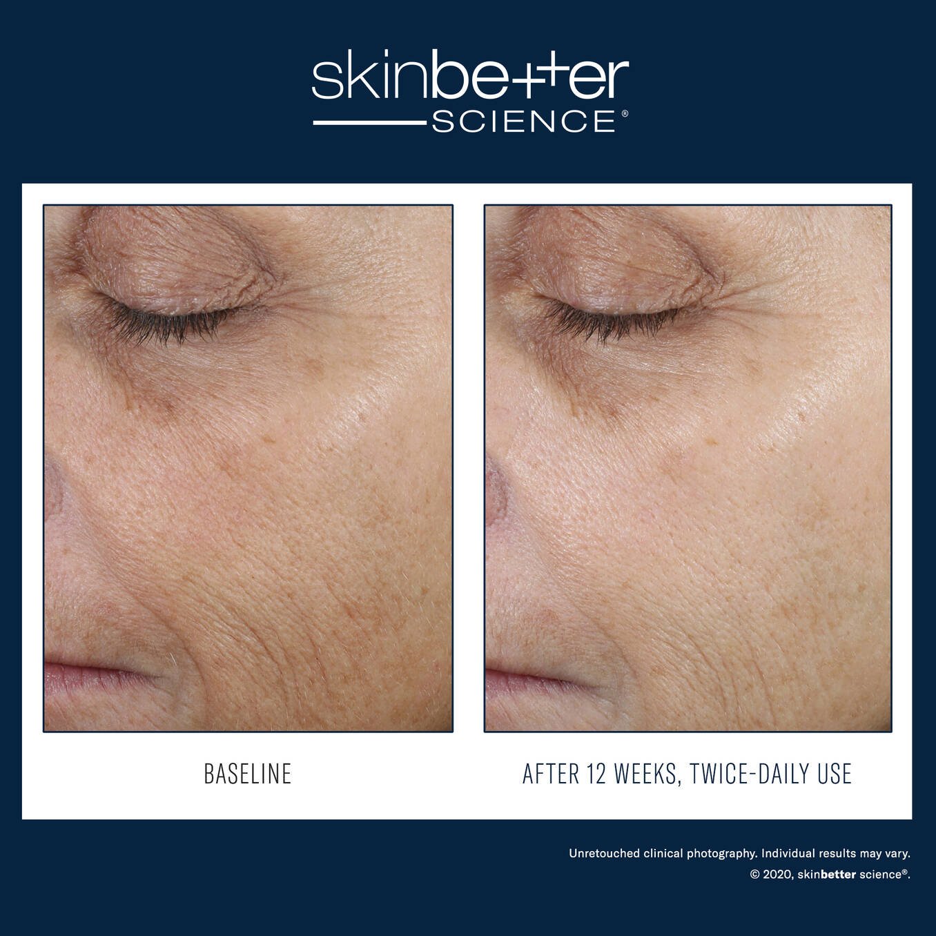 SkinBetter Even Tone Correcting Serum 50ml